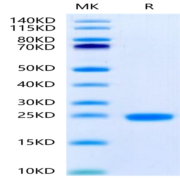 Human IL-1F10/IL-38 Protein (ILF-HE138)