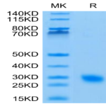 Human IL-17F Protein (ILF-HM119)