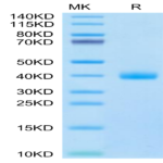 Cynomolgus IL-22R alpha 1 Protein (ILR-CM122)