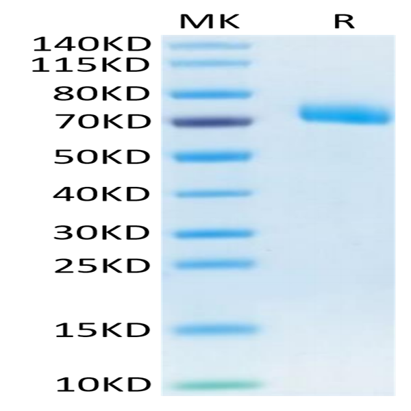Human IL-12 R beta 1/CD212 Protein (ILR-HM112)