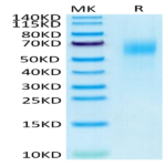 Human IL-13Ra1 Protein (ILR-HM1R1)