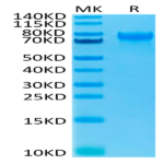 Human IL-15RA/IL-15 R alpha/CD215 Protein (ILR-HM215)