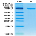 Human IL-21R Protein (ILR-HM221)