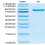 Human IL-5 R alpha/CD125 Protein (ILR-HM25R)
