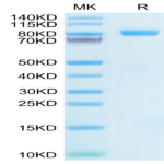 Human IL-6 R alpha/CD126 Protein (ILR-HM26R)