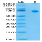 Human IL-13Ra2 Protein (ILR-HM2R2)