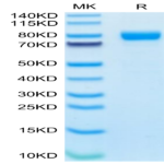 Human IL-1R3/IL-1 RAcP Protein (ILR-HM2R3)