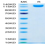 Human IL-31 RA Protein (ILR-HM2RA)