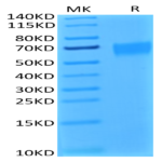 Biotinylated Human IL-17R alpha/CD217 Protein (ILR-HM417B)