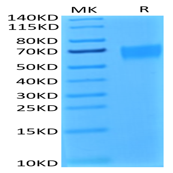 Biotinylated Human IL-17R alpha/CD217 Protein (ILR-HM417B)