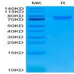 Human IL-6 R alpha/CD126 Protein (ILR-HM46R)