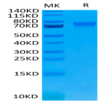Biotinylated Human IL-6 R alpha/CD126 Protein (ILR-HM46RB)