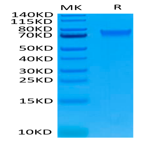 Biotinylated Human IL-6 R alpha/CD126 Protein (ILR-HM46RB)