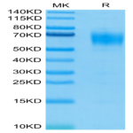 Biotinylated Human IL-13Ra1 Protein (ILR-HM4R1B)