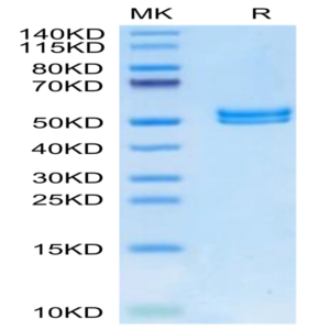 Mouse IL-11R alpha Protein (ILR-MM111)