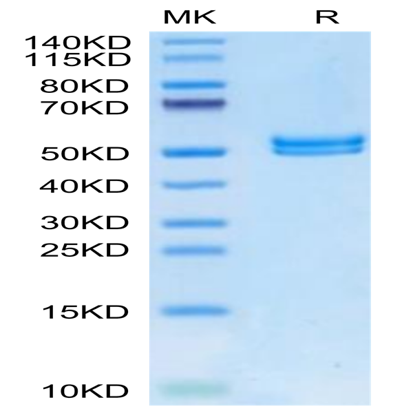 Mouse IL-11R alpha Protein (ILR-MM111)