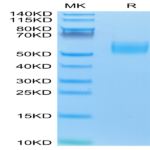 Mouse IL-13Ra1 Protein (ILR-MM1R1)