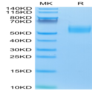 Mouse IL-13Ra1 Protein (ILR-MM1R1)