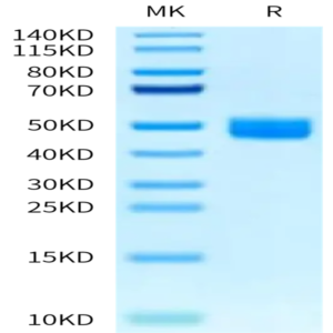 Mouse IL-13Ra2 Protein (ILR-MM1R2)
