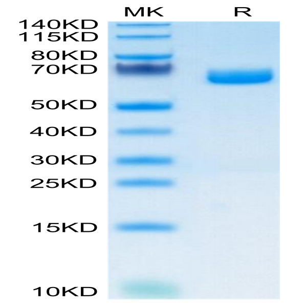 Mouse IL-22R alpha 1 Protein (ILR-MM222)