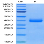 Rat IL-22R alpha 1 Protein (ILR-RM122)