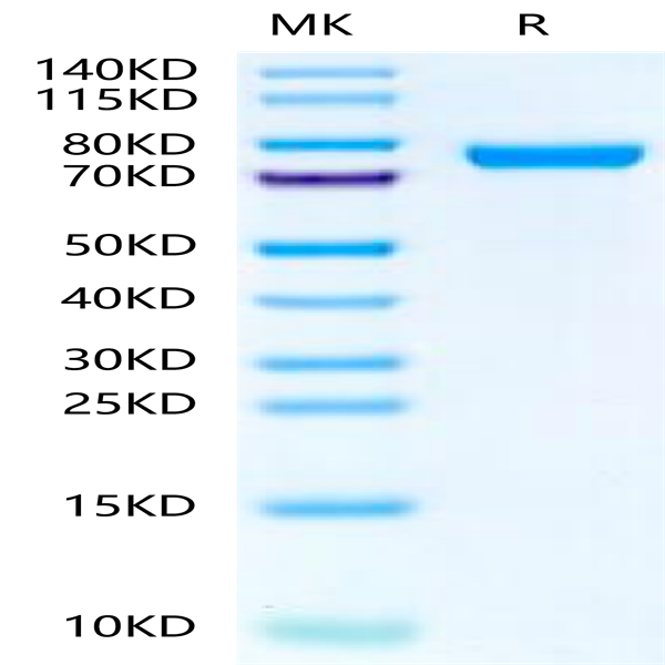 Rat IL-13Ra2 Protein (ILR-RM2R2)