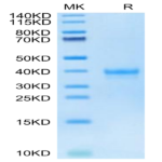 Human IGSF11 Protein (ISF-HM111)