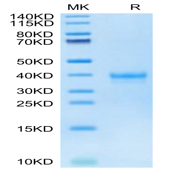 Human IGSF11 Protein (ISF-HM111)