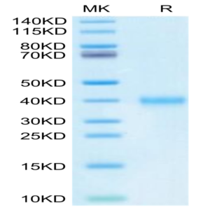 Mouse IGSF11 Protein (ISF-MM111)