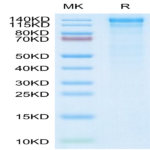 Human Integrin alpha 10 beta 1 (ITGA10&ITGB1) Heterodimer Protein (ITG-HM110)