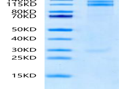 Human Integrin alpha 8 beta 1 (ITGA8&ITGB1) Heterodimer Protein (ITG-HM18B)