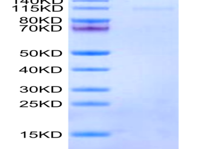 Human Integrin alpha 1 beta 1 (ITGA1&ITGB1) Heterodimer Protein (ITG-HM1A1)