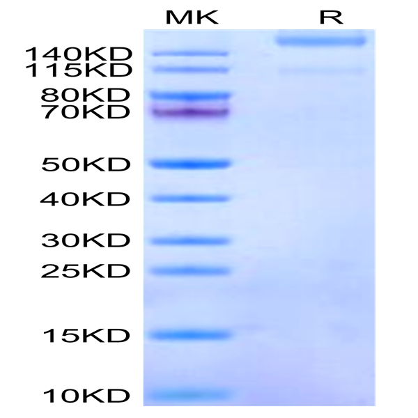 Human Integrin alpha 1 beta 1 (ITGA1&ITGB1) Heterodimer Protein (ITG-HM1A1) Human Integrin alpha 1 beta 1 (ITGA1&ITGB1) Heterodimer Protein (ITG-HM1A1)