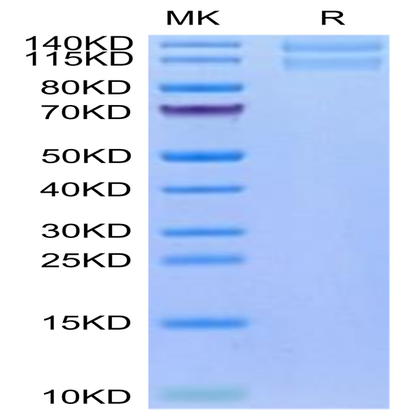 Human Integrin alpha 2 beta 1 (ITGA2&ITGB1) Heterodimer Protein (ITG-HM1AB)