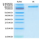 Human ITGB6 Protein (ITG-HM1B6)