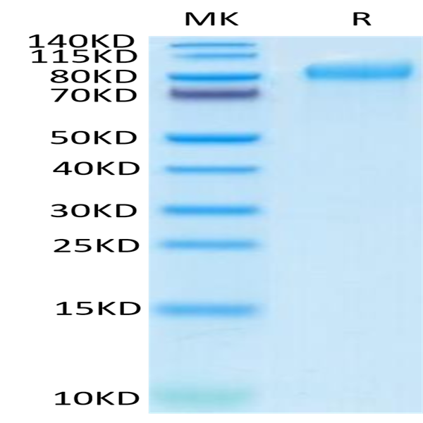 Human ITGB6 Protein (ITG-HM1B6)