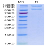 Human Integrin alpha X beta 2 (ITGAX&ITGB2) Heterodimer Protein (ITG-HM1XB)