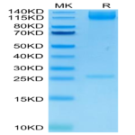 Human Integrin alpha 5 beta 1 (ITGA5&ITGB1) Heterodimer Protein (ITG-HM451)