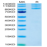 Human Integrin alpha V beta 5 (ITGAV&ITGB5) Heterodimer Protein (ITG-HM4V5)