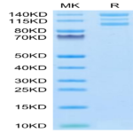 Human Integrin alpha V beta 6 (ITGAV&ITGB6) Heterodimer Protein (ITG-HM4V6)