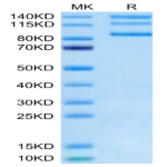 Biotinylated Human Integrin alpha V beta 8 (ITGAV&ITGB8) Heterodimer Protein (ITG-HM4V8B)