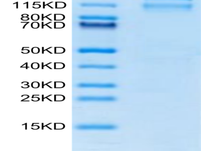 Mouse Integrin alpha 10 beta 1 (ITGA10&ITGB1) Heterodimer Protein (ITG-MM110)