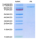 Mouse Integrin alpha 2B beta 3 (ITGA2B&ITGB3) Heterodimer Protein (ITG-MM12B)