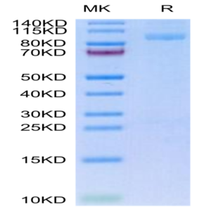 Mouse Integrin alpha 2B beta 3 (ITGA2B&ITGB3) Heterodimer Protein (ITG-MM12B)