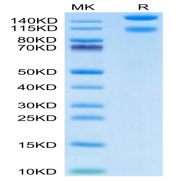 Mouse Integrin alpha 1 beta 1 (ITGA1&ITGB1) Heterodimer Protein (ITG-MM1A1)