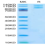Mouse Integrin alpha V beta 6 (ITGAV&ITGB6) Heterodimer Protein (ITG-MM1V6)
