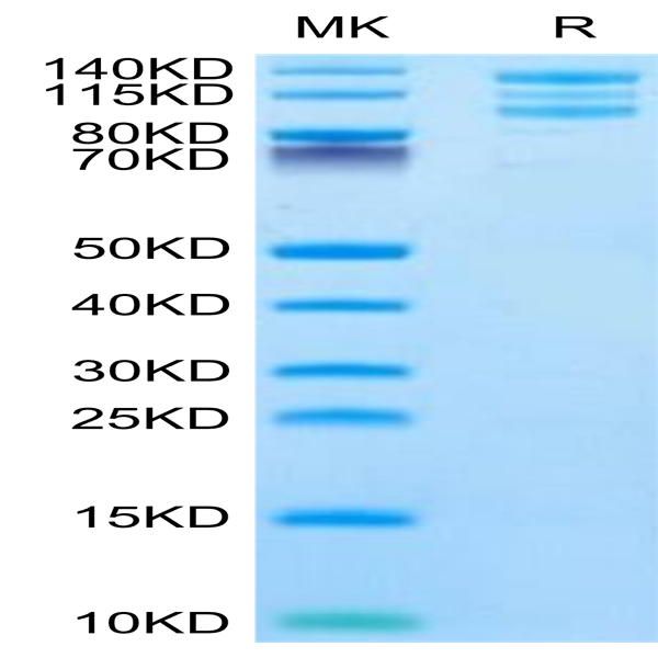 Rhesus macaque Integrin alpha V beta 6 (ITGAV&ITGB6) Heterodimer Protein (ITG-RM1V6)