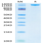 Human Jagged 1/JAG1 Protein (JAG-HM101)