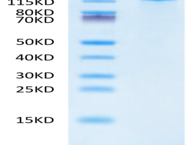 Human Jagged 1/JAG1 Protein (JAG-HM101)