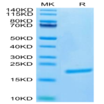Biotinylated Human FGF-7/KGF Protein (Primary Amine Labeling) (KGF-HE101B)